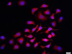 PI3 kinase p85 alpha subunit Antibody in Immunocytochemistry (ICC/IF)