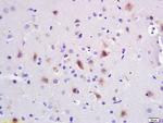 PI3 kinase p85 alpha subunit Antibody in Immunohistochemistry (Paraffin) (IHC (P))