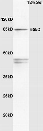 PI3 kinase p85 alpha subunit Antibody in Western Blot (WB)