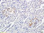 PP-1B Antibody in Immunohistochemistry (Paraffin) (IHC (P))