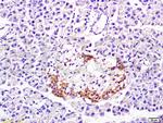 PP-1B Antibody in Immunohistochemistry (Paraffin) (IHC (P))