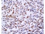 Caspase-6 Antibody in Immunohistochemistry (Paraffin) (IHC (P))