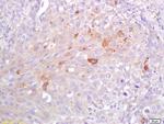 CRP Antibody in Immunohistochemistry (Paraffin) (IHC (P))