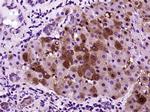 CRP Antibody in Immunohistochemistry (Paraffin) (IHC (P))