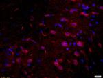 Tau protein Antibody in Immunohistochemistry (Paraffin) (IHC (P))