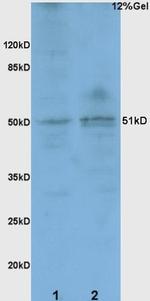 BACE1 Antibody in Western Blot (WB)