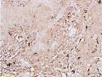 EGFR Antibody in Immunohistochemistry (Paraffin) (IHC (P))