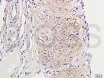 Neurokinin B receptor Antibody in Immunohistochemistry (Paraffin) (IHC (P))