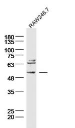 Neurokinin B receptor Antibody in Western Blot (WB)