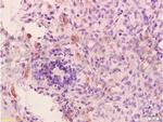 VEGFR1 Antibody in Immunohistochemistry (Paraffin) (IHC (P))