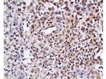 Estrogen Receptor alpha + beta Antibody in Immunohistochemistry (Paraffin) (IHC (P))