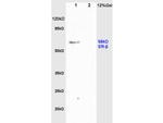 Estrogen Receptor alpha + beta Antibody in Western Blot (WB)