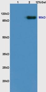 TrkB Antibody in Western Blot (WB)