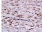 RAGE Antibody in Immunohistochemistry (Paraffin) (IHC (P))