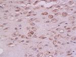 PTP1B Antibody in Immunohistochemistry (Paraffin) (IHC (P))