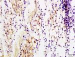 PDGF B Antibody in Immunohistochemistry (Paraffin) (IHC (P))