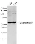 Preproendothelin 1 Antibody in Western Blot (WB)