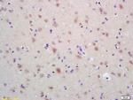 HSP60 Antibody in Immunohistochemistry (Paraffin) (IHC (P))