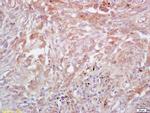 Trk A + B + C Antibody in Immunohistochemistry (Paraffin) (IHC (P))