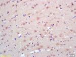 Trk A + B + C Antibody in Immunohistochemistry (Paraffin) (IHC (P))