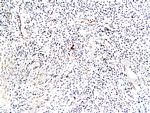 TrkA Antibody in Immunohistochemistry (Paraffin) (IHC (P))