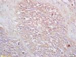 VPAC2R Antibody in Immunohistochemistry (Paraffin) (IHC (P))