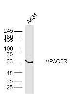 VPAC2R Antibody in Western Blot (WB)