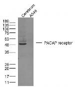 PACAP receptor 1 Antibody in Western Blot (WB)