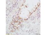 Fas Ligand Antibody in Immunohistochemistry (Paraffin) (IHC (P))