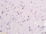 NMDAR2B Antibody in Immunohistochemistry (Paraffin) (IHC (P))