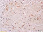 NMDAR2B Antibody in Immunohistochemistry (Paraffin) (IHC (P))