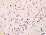 FGF1 Antibody in Immunohistochemistry (Paraffin) (IHC (P))