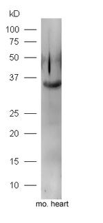 FGF1 Antibody in Western Blot (WB)