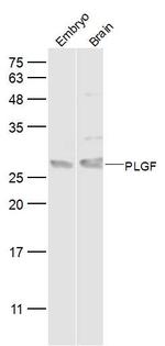 PLGF Antibody in Western Blot (WB)