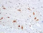 PMP22 Antibody in Immunohistochemistry (Paraffin) (IHC (P))