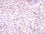 EphB2 R Antibody in Immunohistochemistry (Paraffin) (IHC (P))