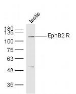 EphB2 R Antibody in Western Blot (WB)