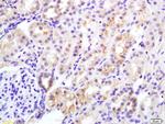 Insulin Receptor Alpha Antibody in Immunohistochemistry (Paraffin) (IHC (P))