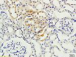 PKC beta Antibody in Immunohistochemistry (Paraffin) (IHC (P))