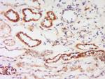 PKC beta Antibody in Immunohistochemistry (Paraffin) (IHC (P))