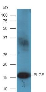 PLGF Antibody in Western Blot (WB)