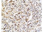 PLGF Antibody in Immunohistochemistry (Paraffin) (IHC (P))