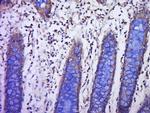 PLGF Antibody in Immunohistochemistry (Paraffin) (IHC (P))