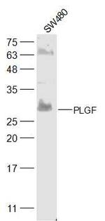 PLGF Antibody in Western Blot (WB)