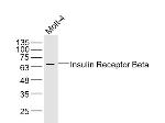 Insulin Receptor Beta Antibody in Western Blot (WB)