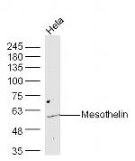 Mesothelin Antibody in Western Blot (WB)