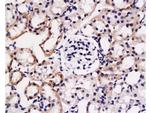 FGL2 Antibody in Immunohistochemistry (Paraffin) (IHC (P))