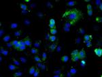 ILK-1 Antibody in Immunocytochemistry (ICC/IF)