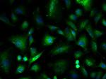 ILK-1 Antibody in Immunocytochemistry (ICC/IF)