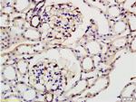 ILK-1 Antibody in Immunohistochemistry (Paraffin) (IHC (P))